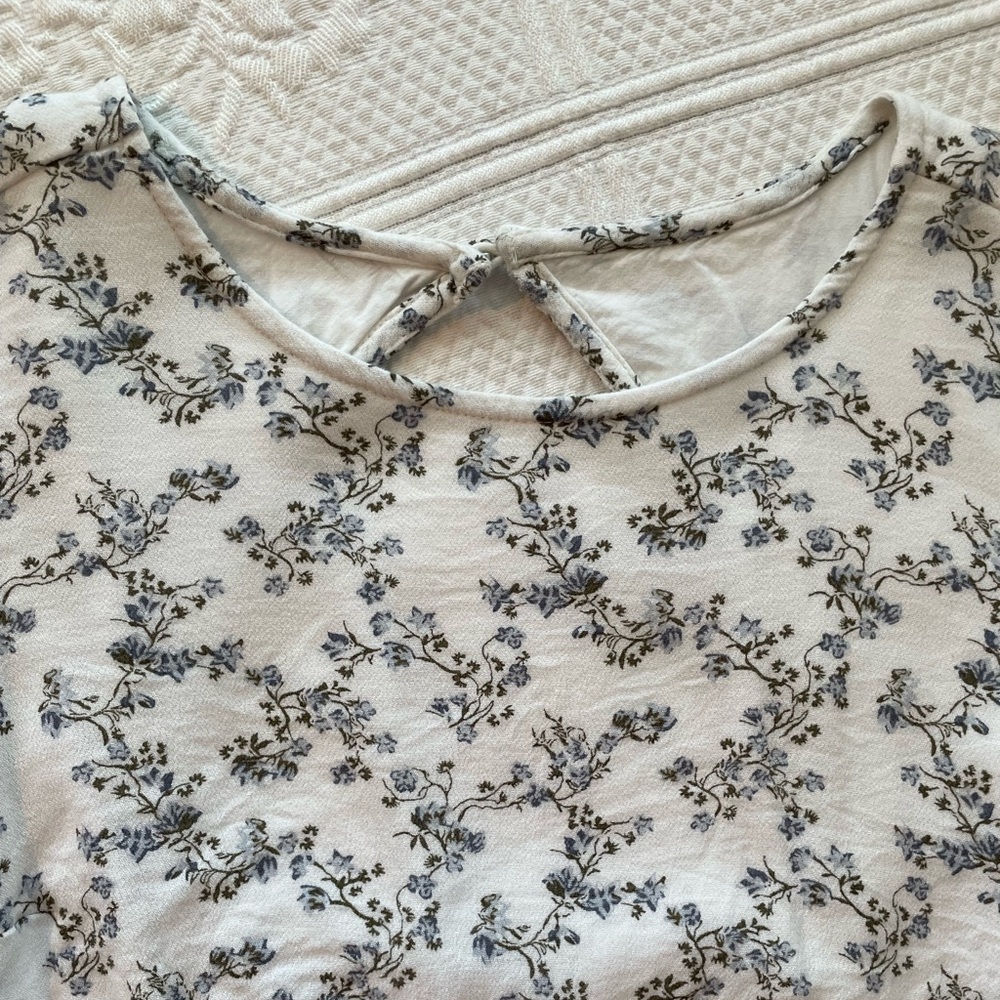 Abercrombie Blue Willow Toile Open Back Short Sleeve Top - Picture 3 of 12